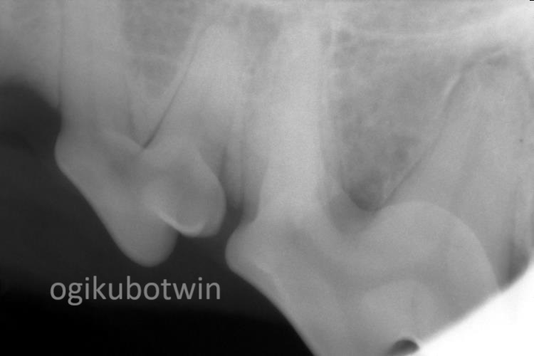 犬の奥歯　再生治療　レントゲン